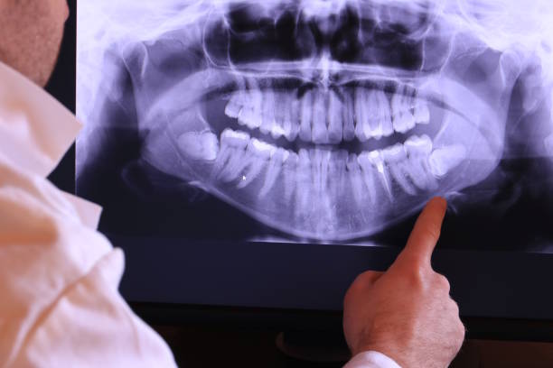 Best Broken Tooth Emergency  in King Of Prussia, PA