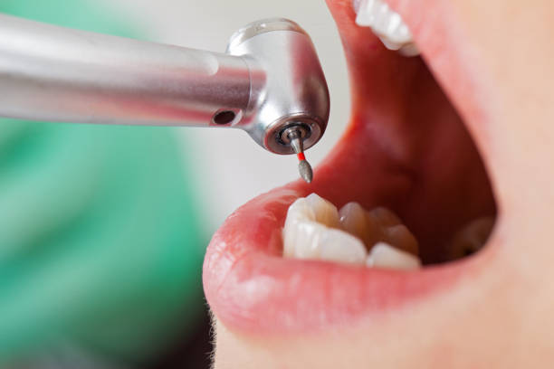 Best Knocked-Out Tooth Emergency  in King Of Prussia, PA
